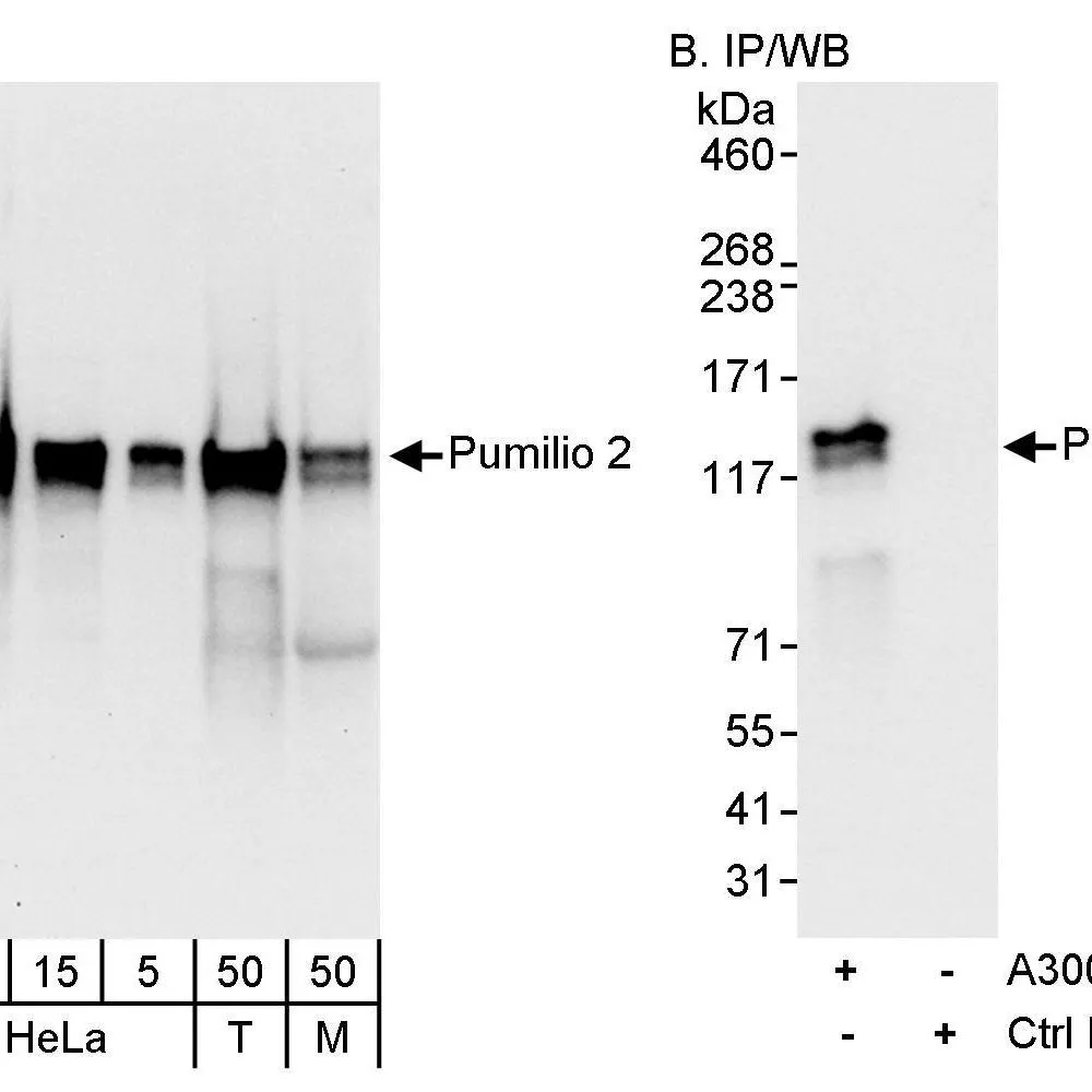 Rabbit anti-Pumilio 2 Antibody, Affinity Purified