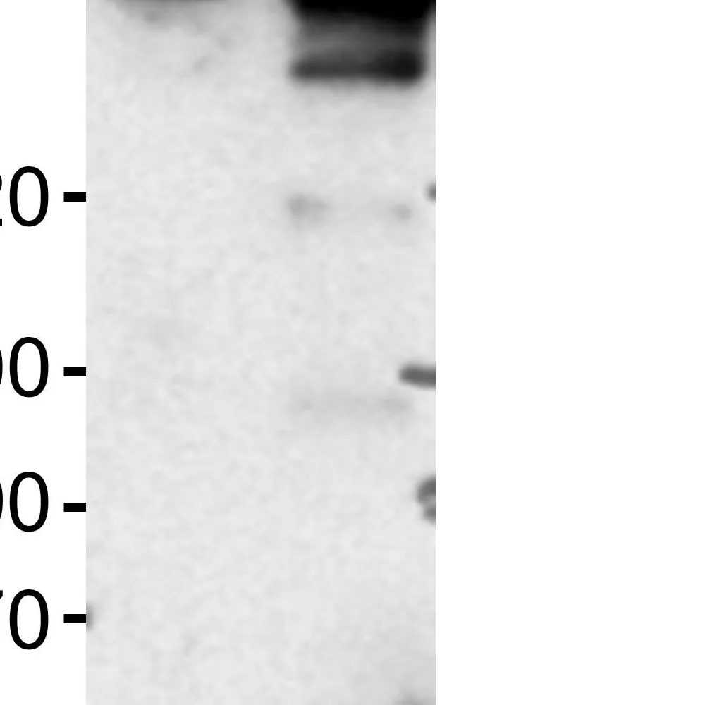 Rabbit anti-FANCI Antibody, Affinity Purified