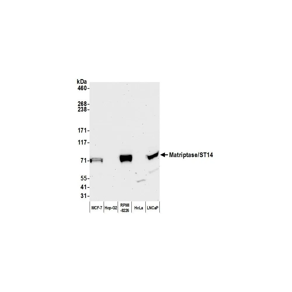 Rabbit anti-Matriptase/ST14 Antibody, Affinity Purified
