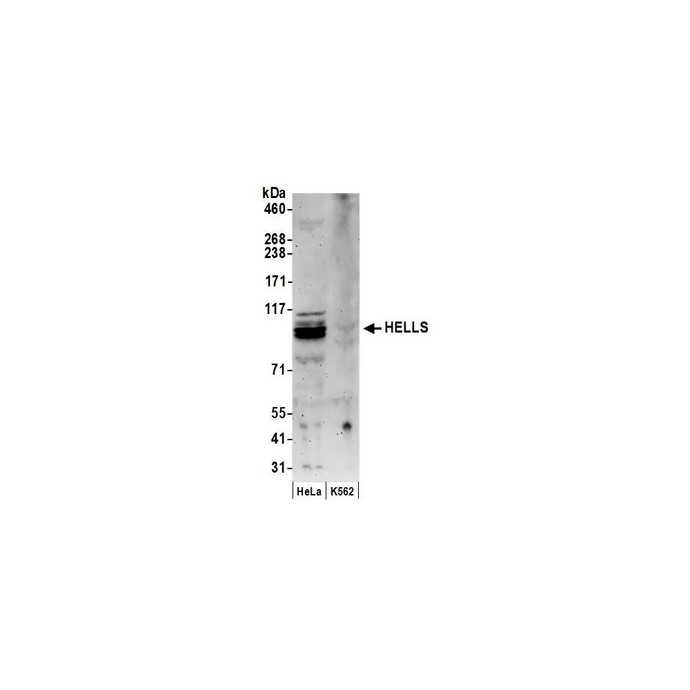 Rabbit anti-HELLS Antibody, Affinity Purified