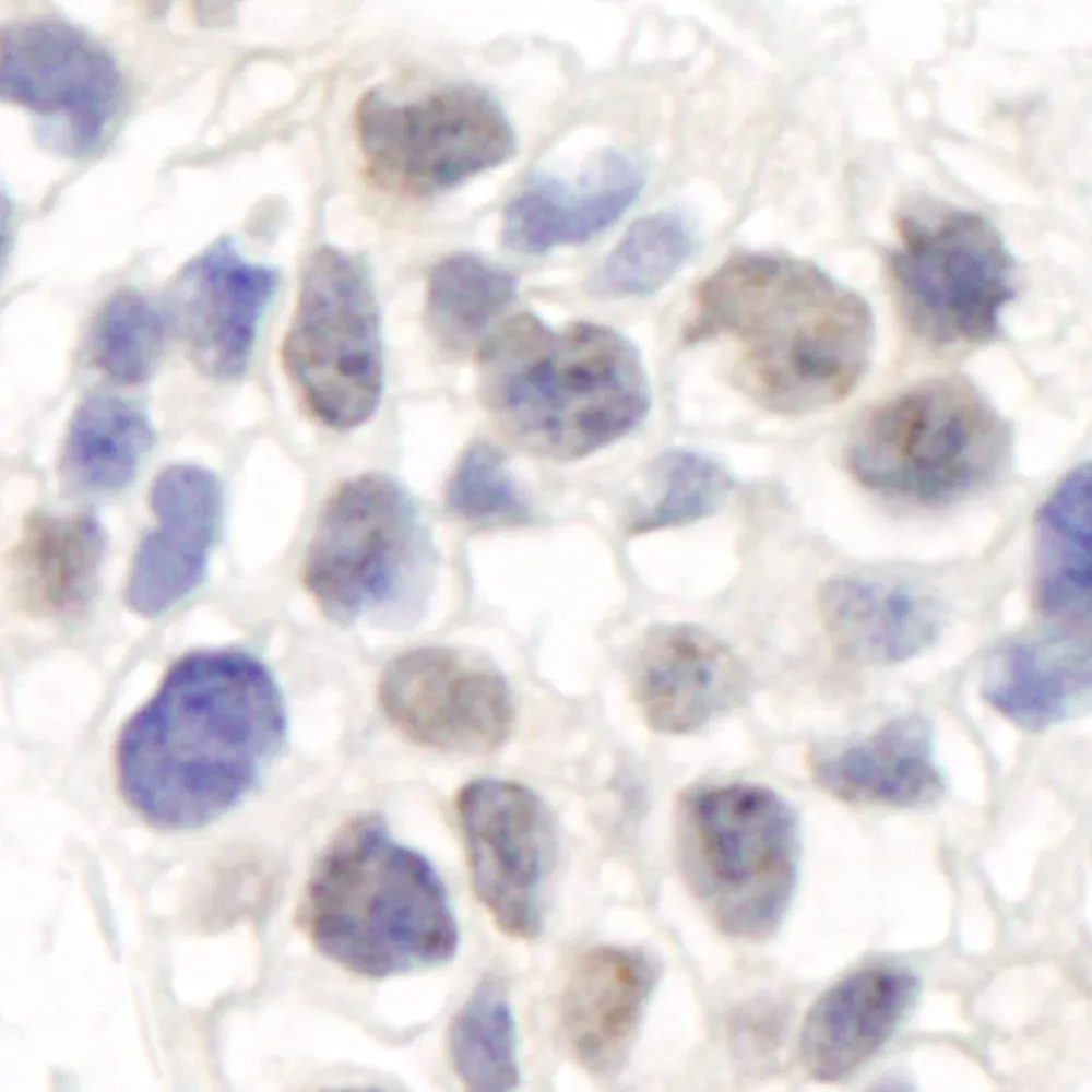 Rabbit anti-Artemis Antibody, Affinity Purified