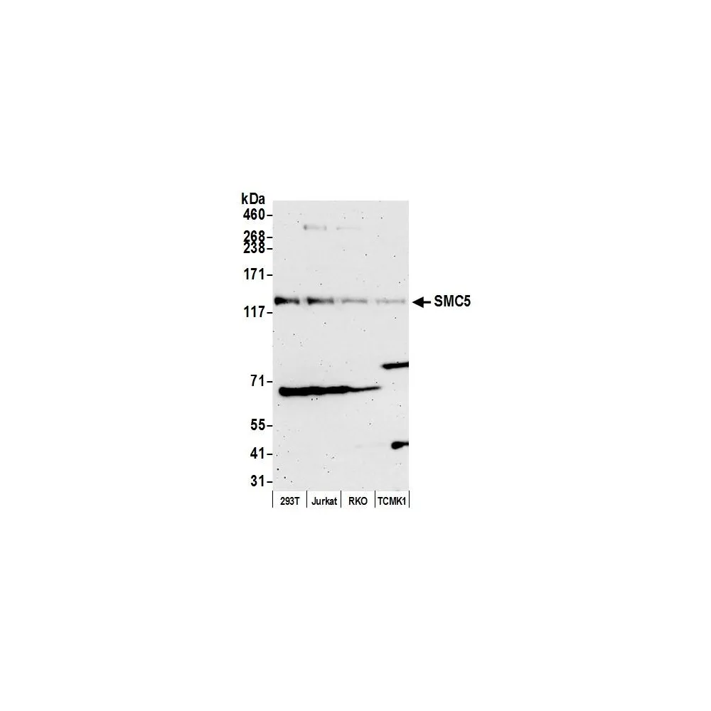 Rabbit anti-SMC5 Antibody, Affinity Purified