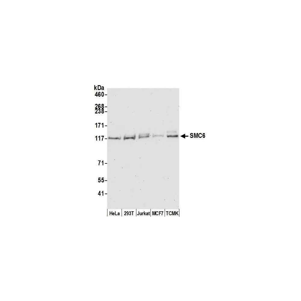 Rabbit anti-SMC6 Antibody, Affinity Purified