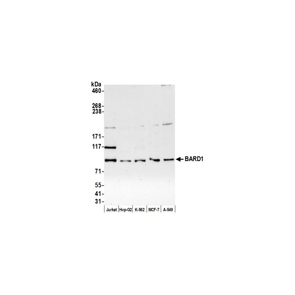 Rabbit anti-BARD1 Antibody, Affinity Purified