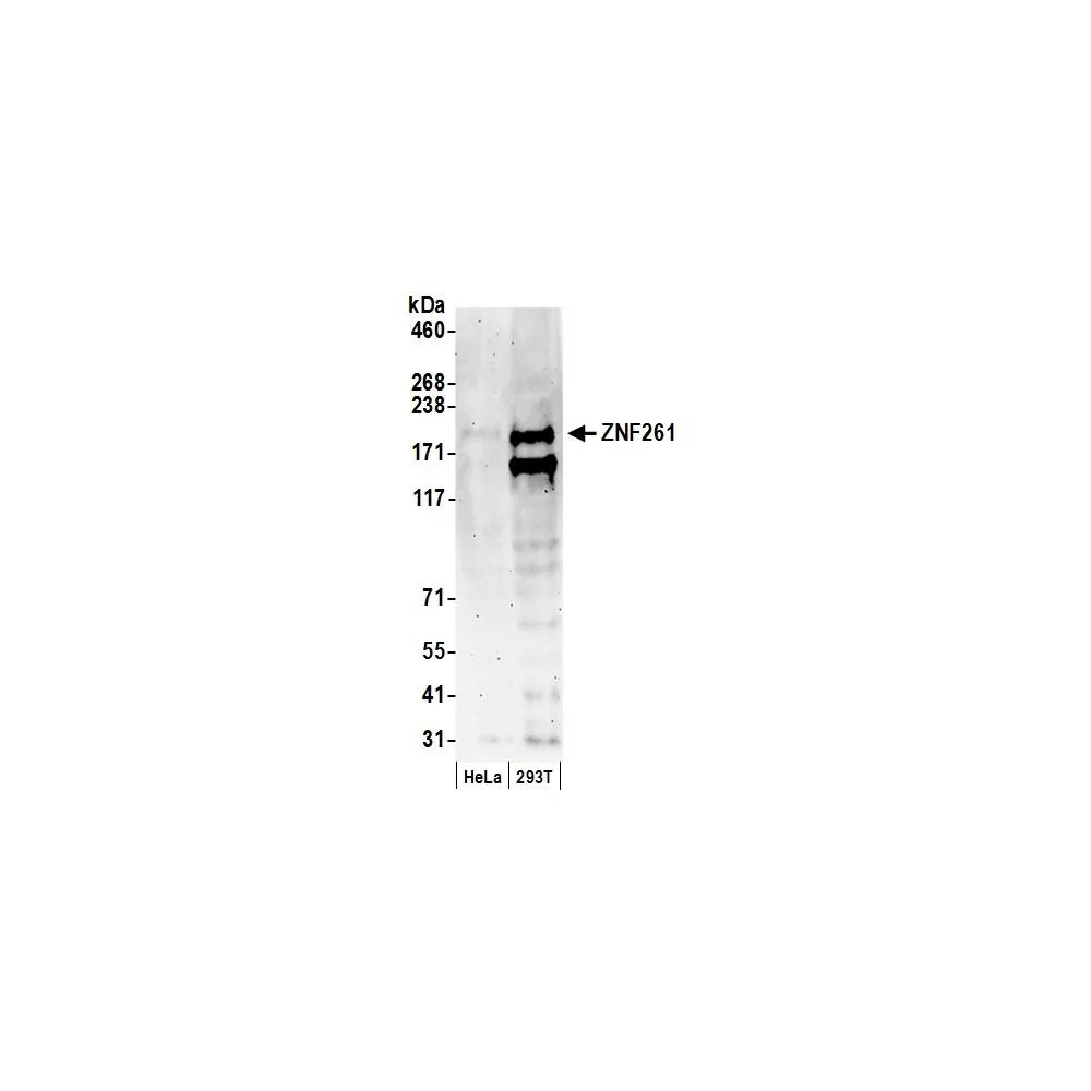 Rabbit anti-ZNF261 Antibody, Affinity Purified