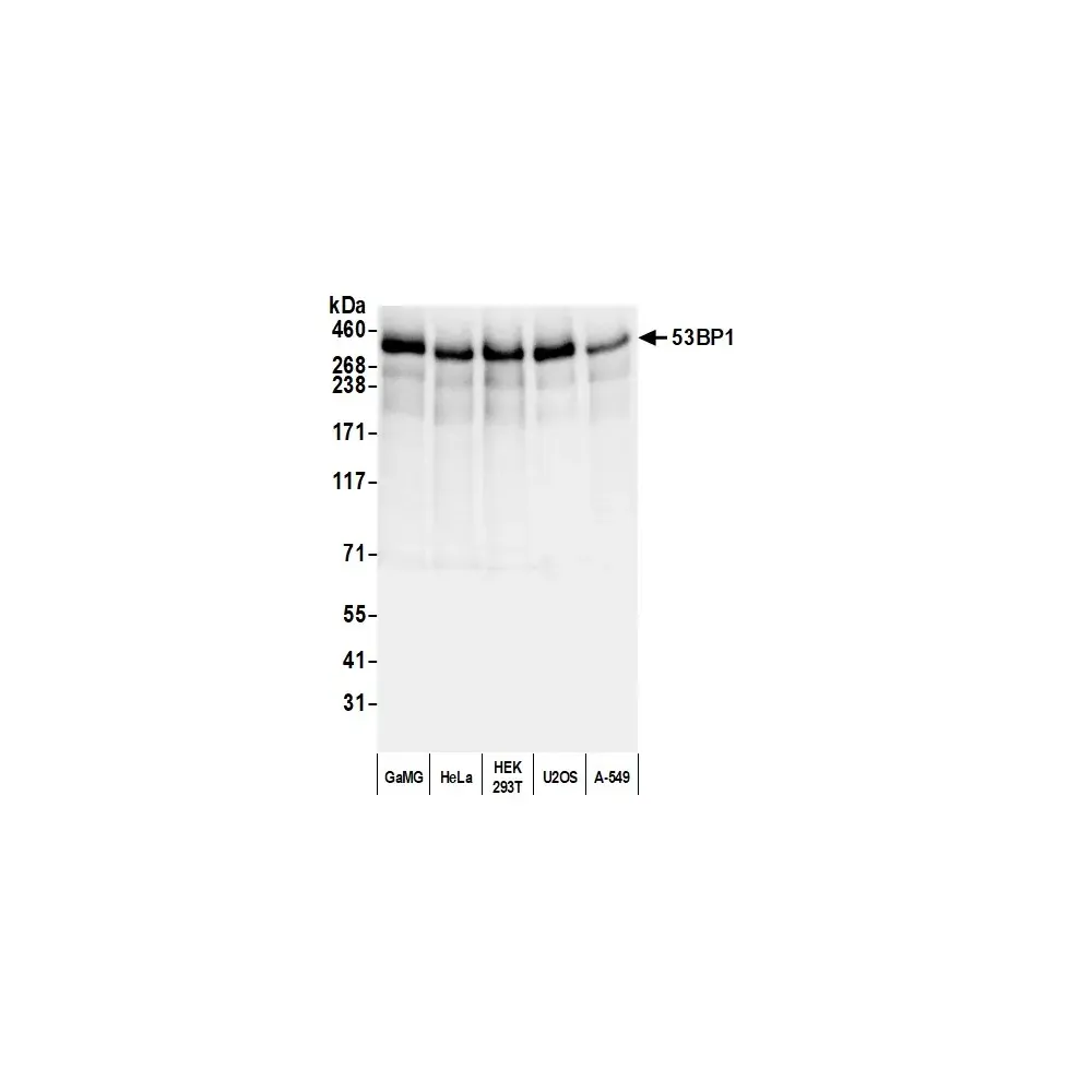 Rabbit anti-53BP1 Antibody, Affinity Purified