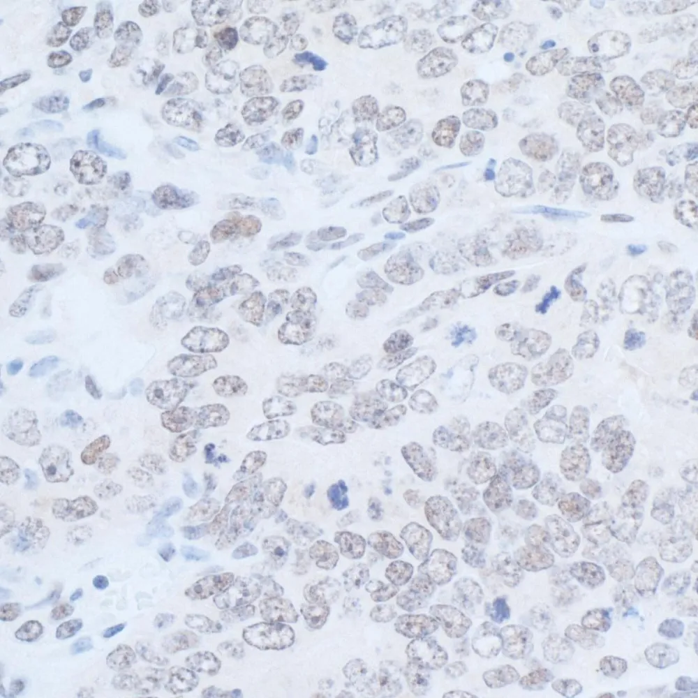 Rabbit anti-Rad6 Antibody, Affinity Purified