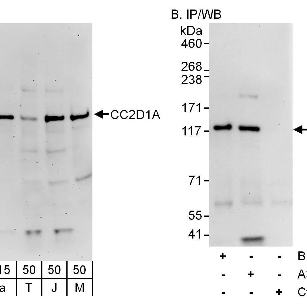 Rabbit anti-CC2D1A Antibody, Affinity Purified