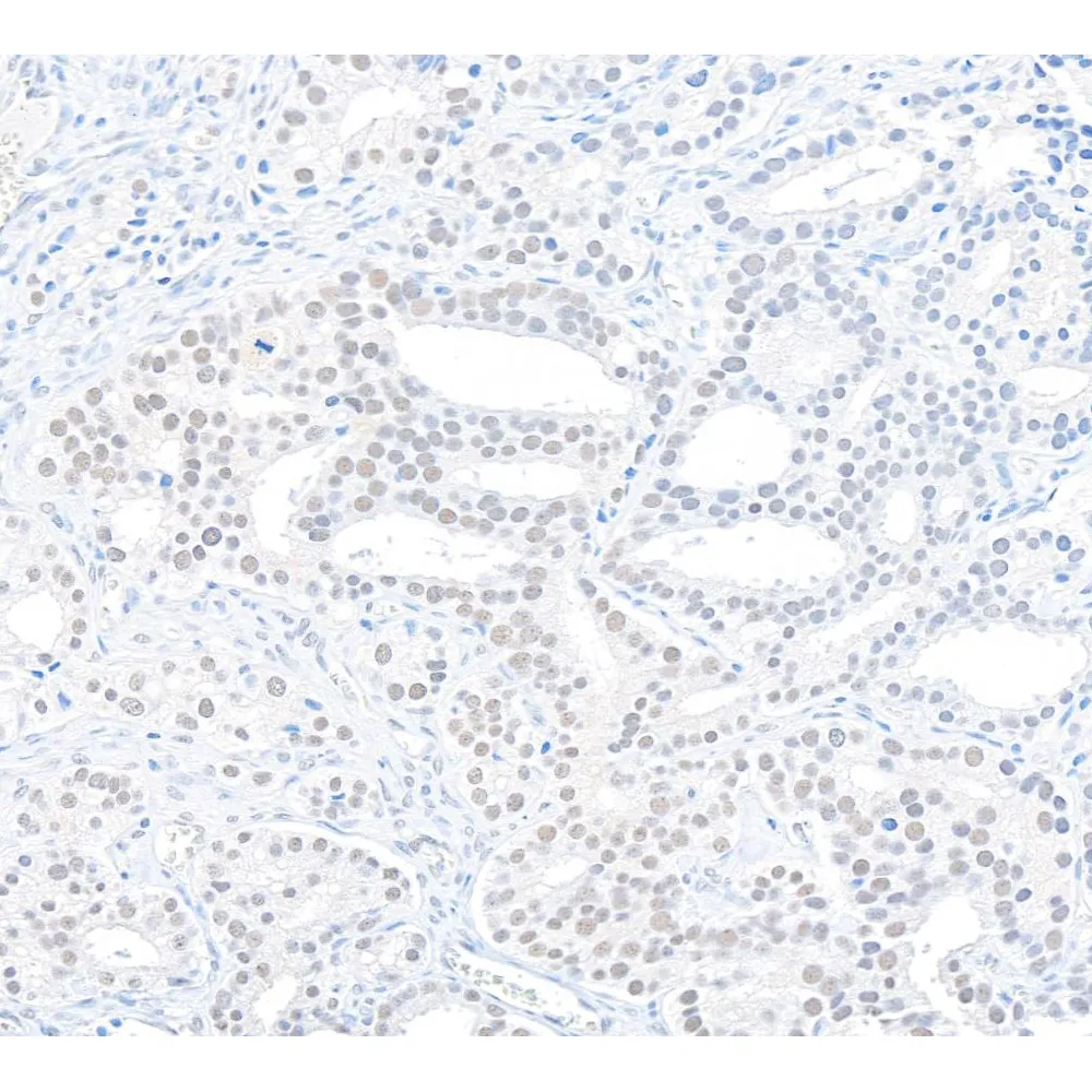 Rabbit anti-Caper Antibody, Affinity Purified