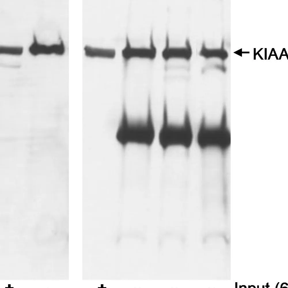 Rabbit anti-KIAA0082 Antibody, Affinity Purified