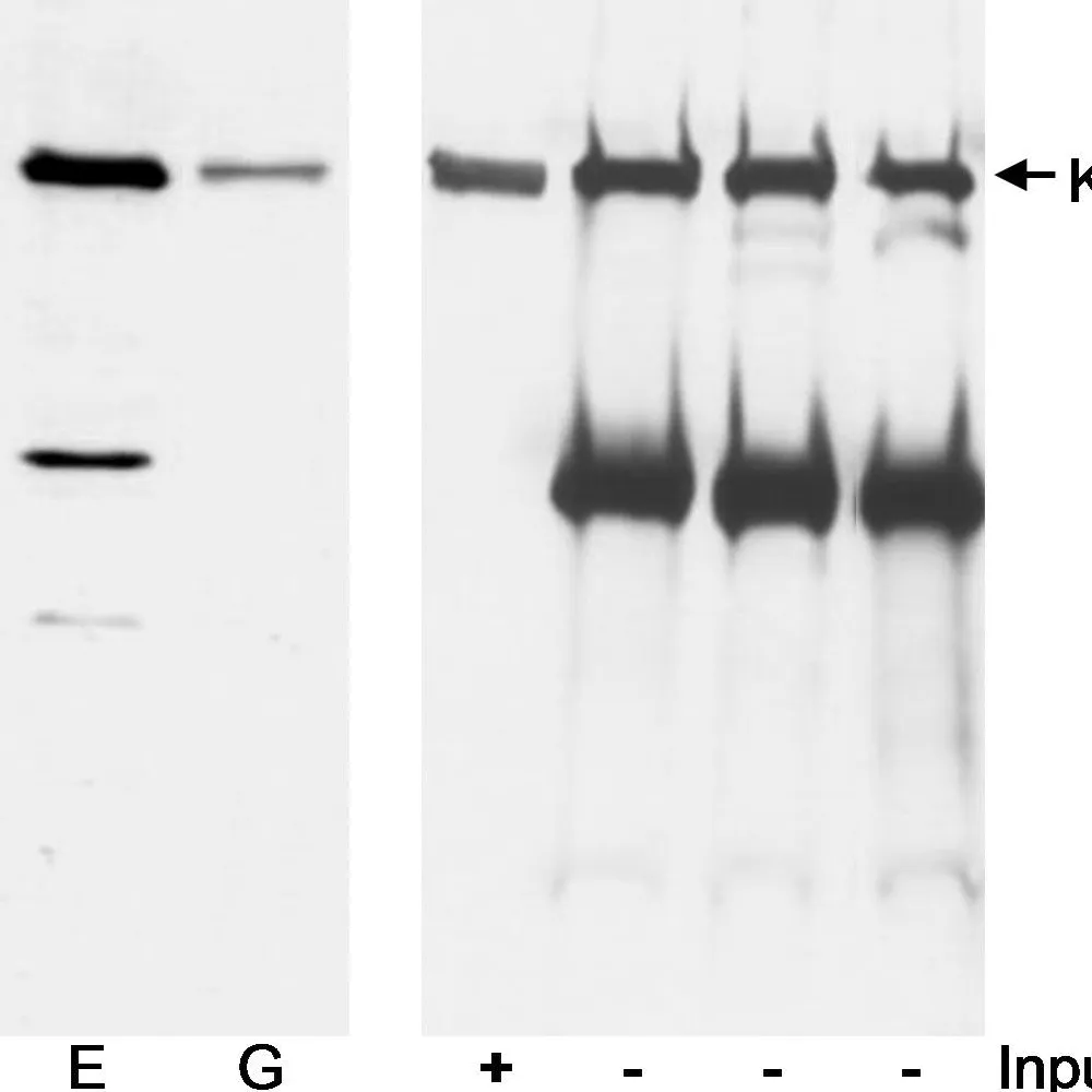 Rabbit anti-KIAA0082 Antibody, Affinity Purified