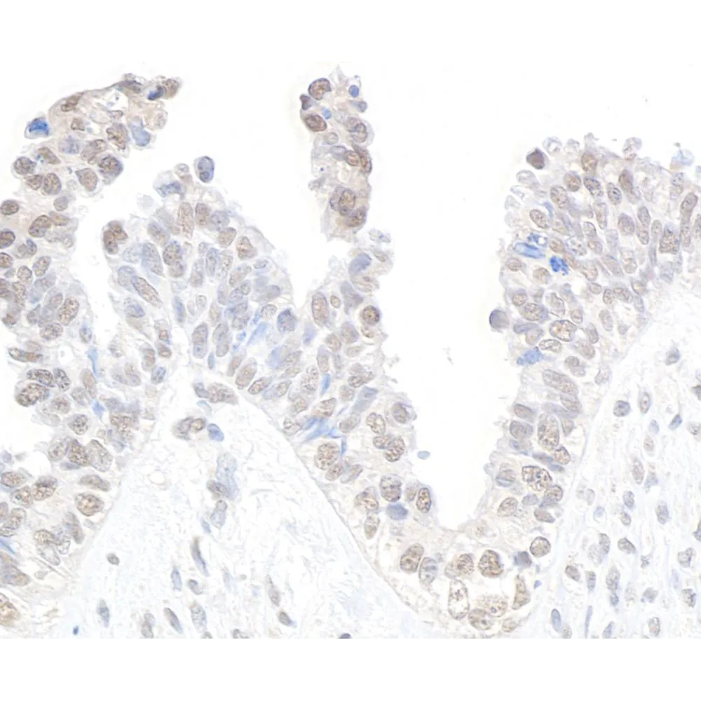 Rabbit anti-CDK11 Antibody, Affinity Purified