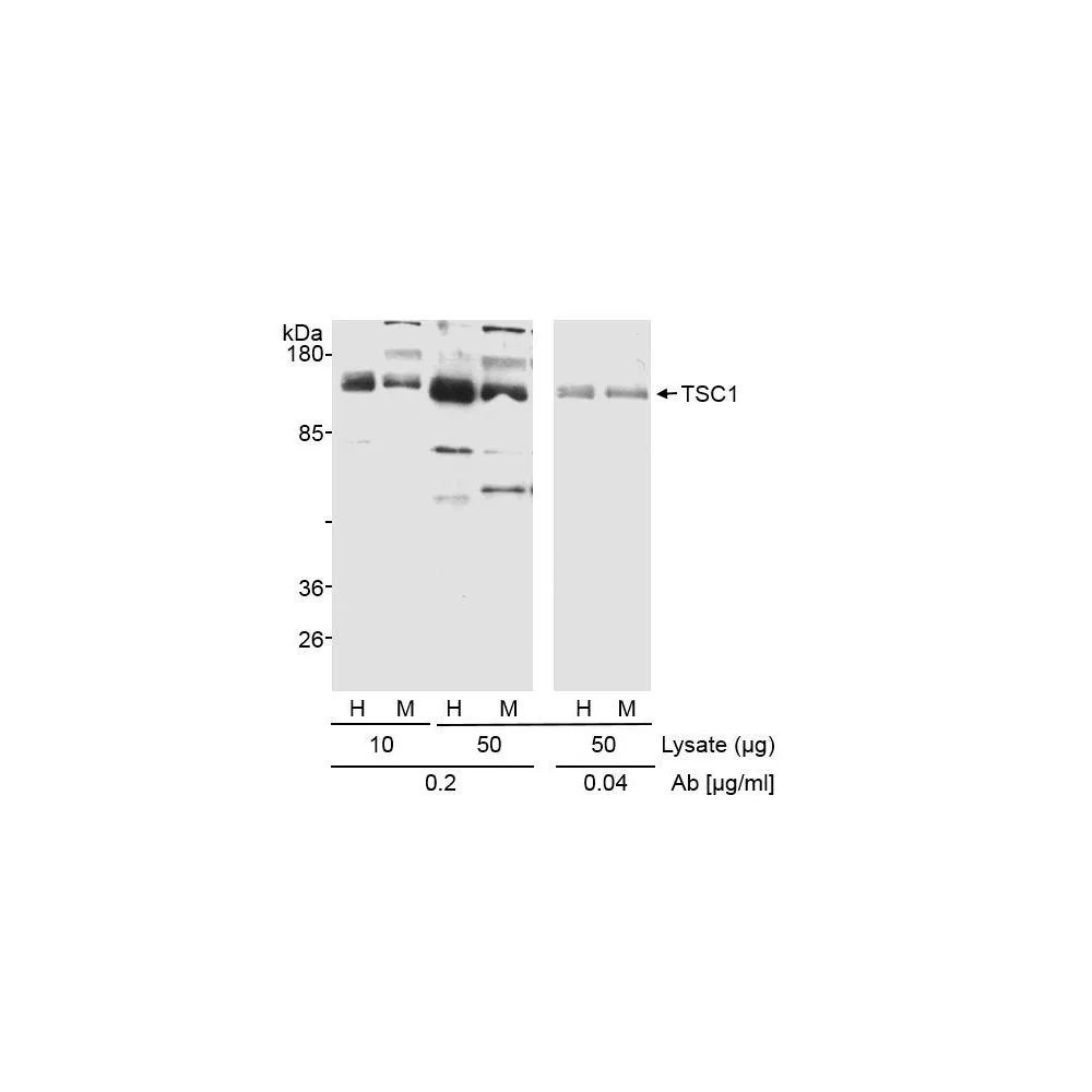 Rabbit anti-TSC1 Antibody, Affinity Purified