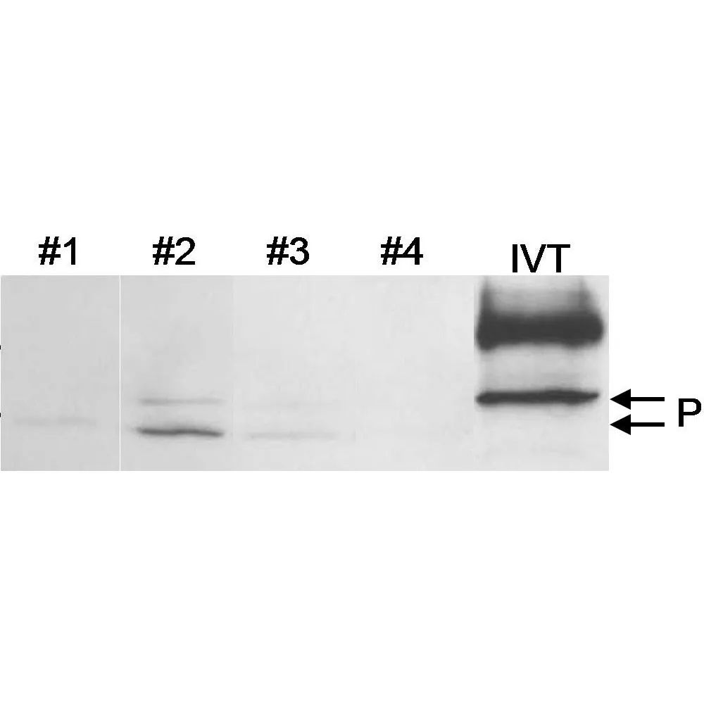 Rabbit anti-PHD4 Antibody, Affinity Purified