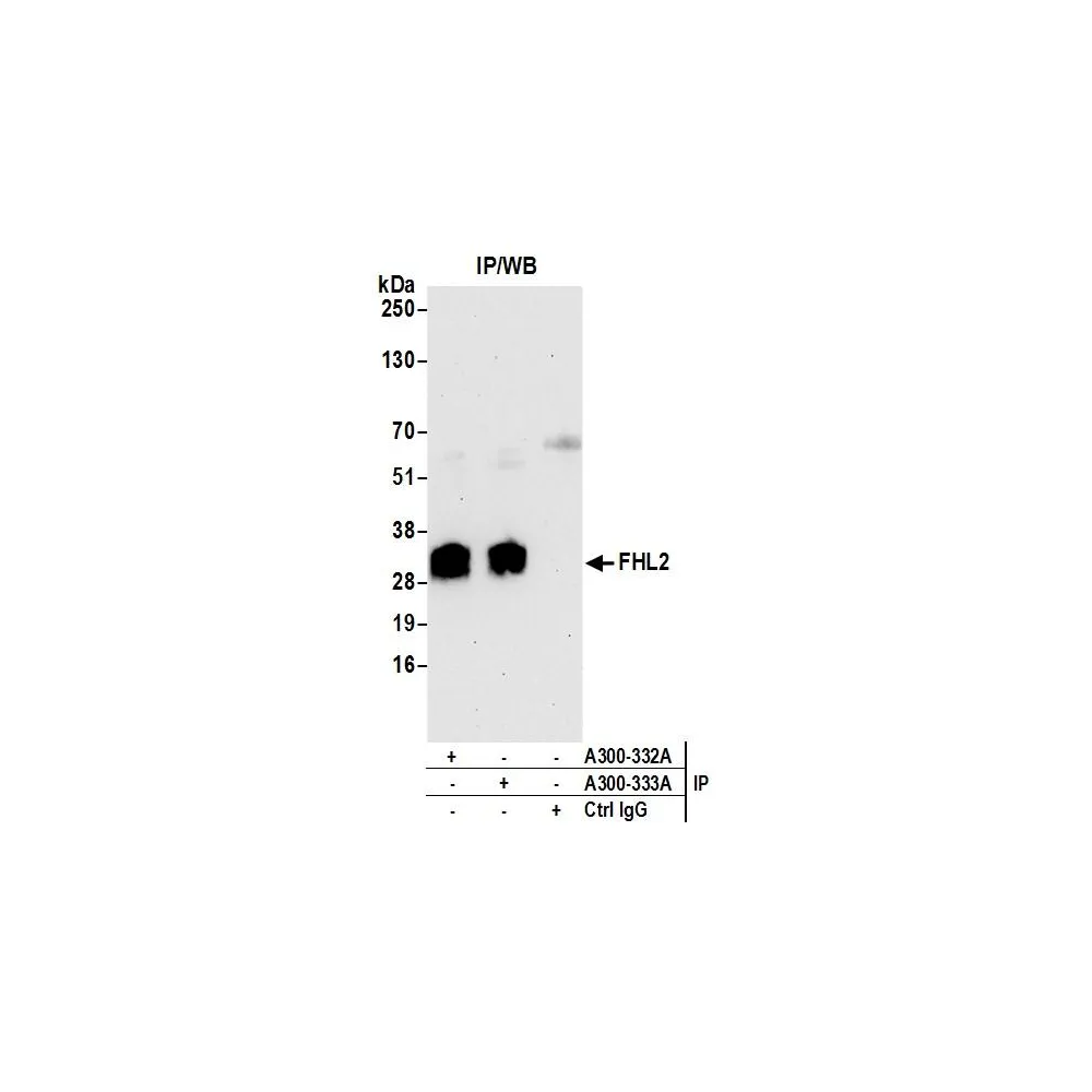 Rabbit anti-FHL2 Antibody, Affinity Purified