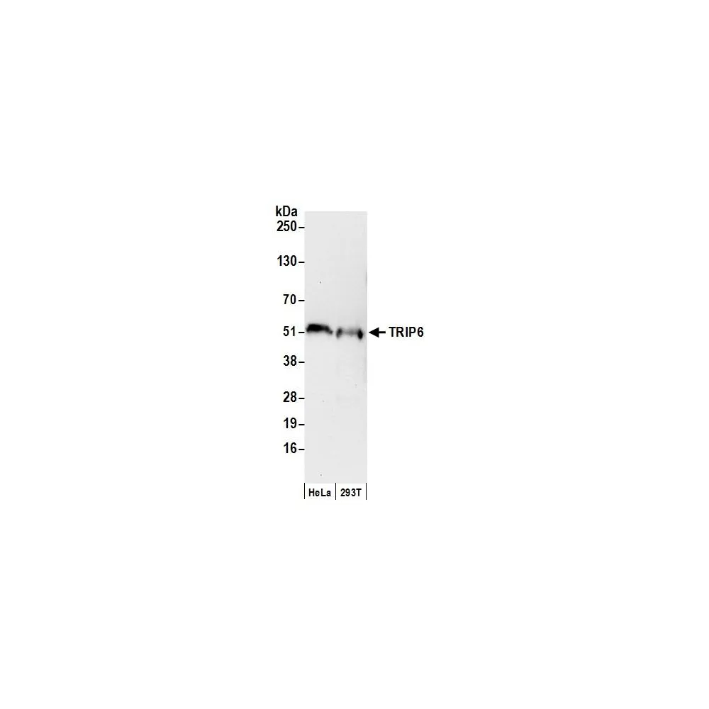 Rabbit anti-TRIP6 Antibody, Affinity Purified