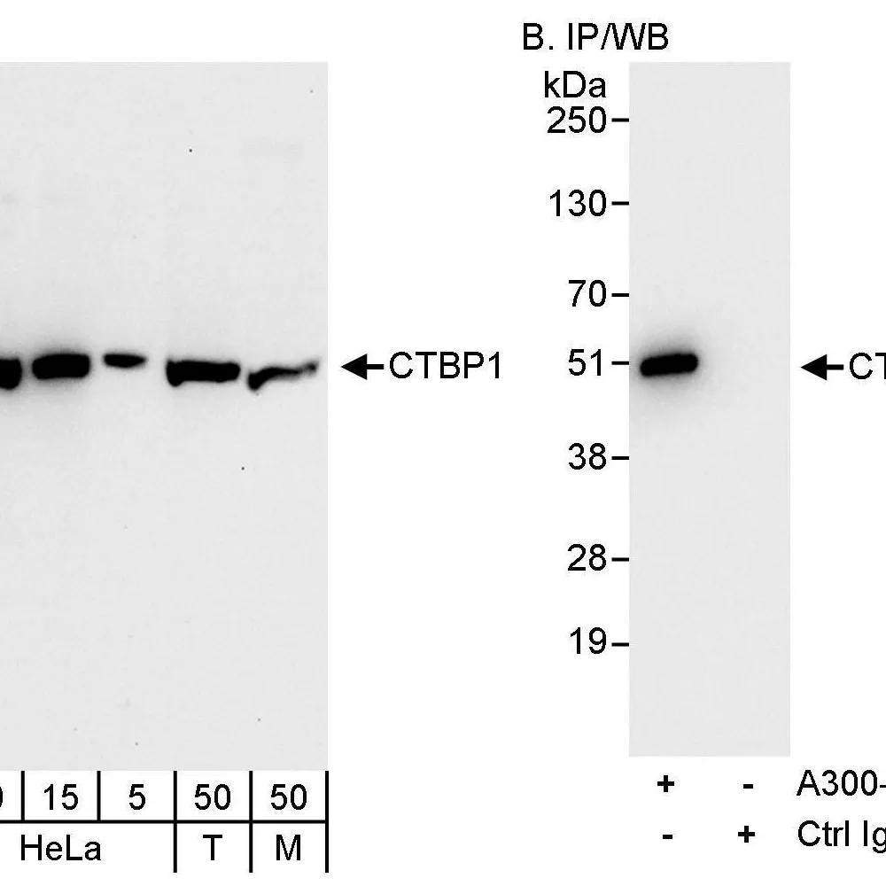 Rabbit anti-CTBP1 Antibody, Affinity Purified