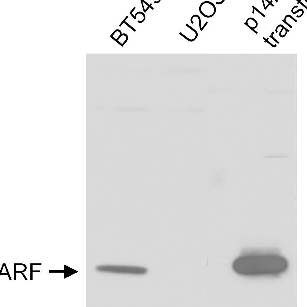 Rabbit anti-p14ARF Antibody, Affinity Purified