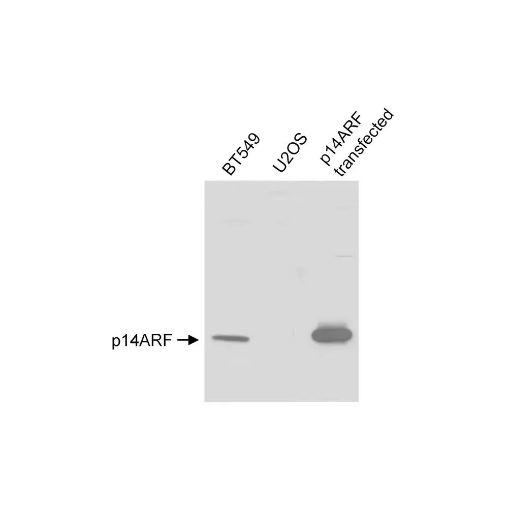 Rabbit anti-p14ARF Antibody, Affinity Purified