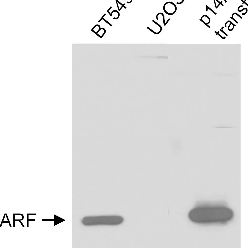 Rabbit anti-p14ARF Antibody, Affinity Purified
