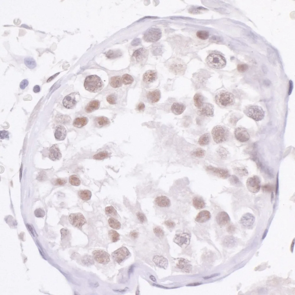 Rabbit anti-NCOA2/SRC2 Antibody, Affinity Purified