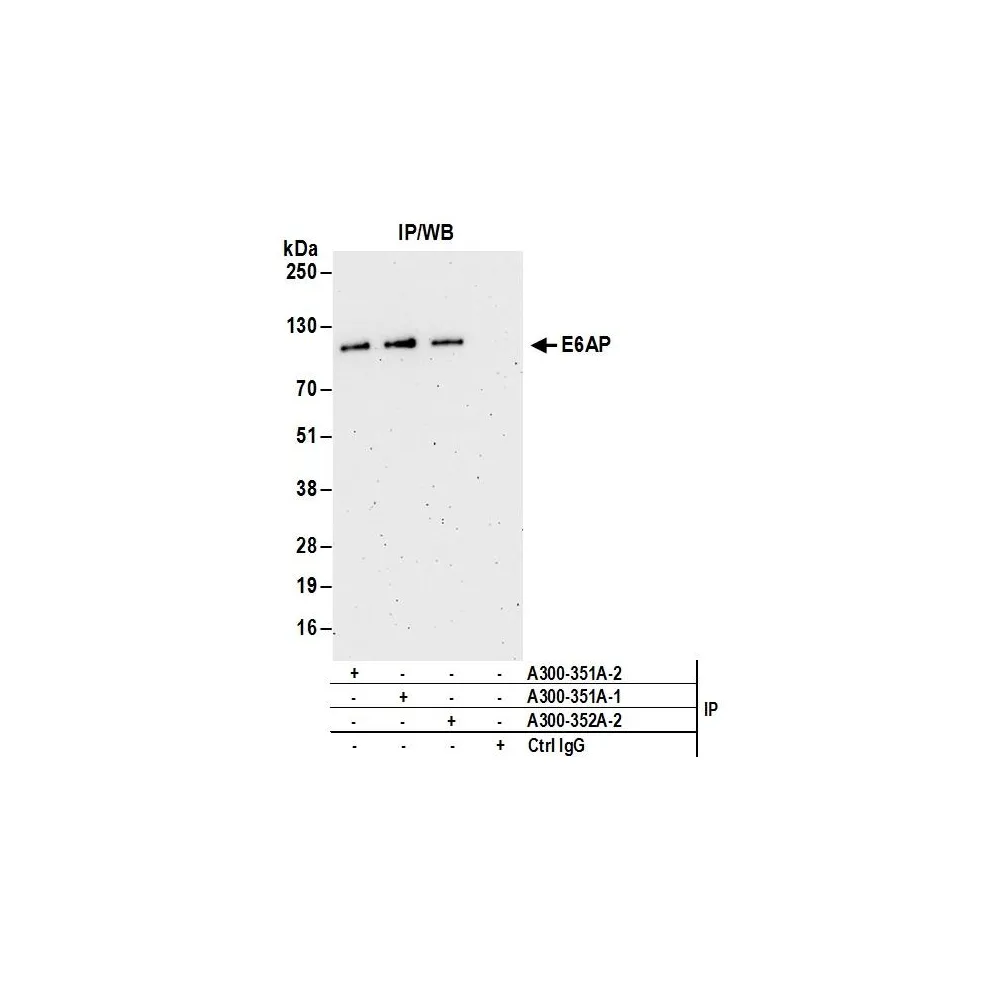 Rabbit anti-E6AP Antibody, Affinity Purified