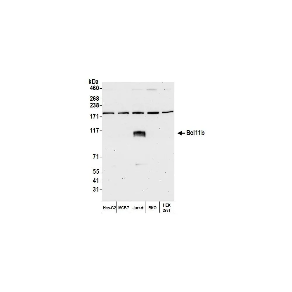 Rabbit anti-Bcl11b Antibody, Affinity Purified
