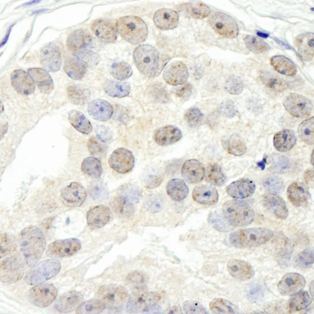 Rabbit anti-DHX15 Antibody, Affinity Purified