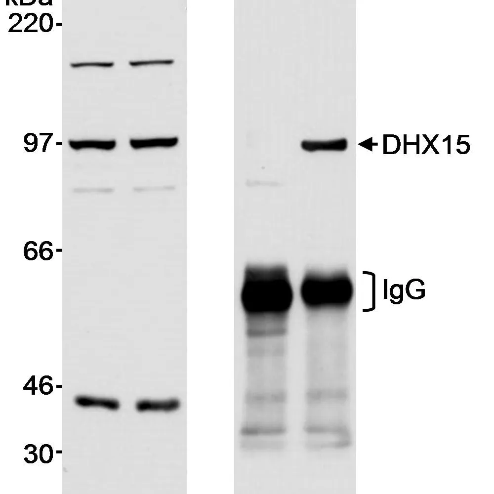 Rabbit anti-DHX15 Antibody, Affinity Purified
