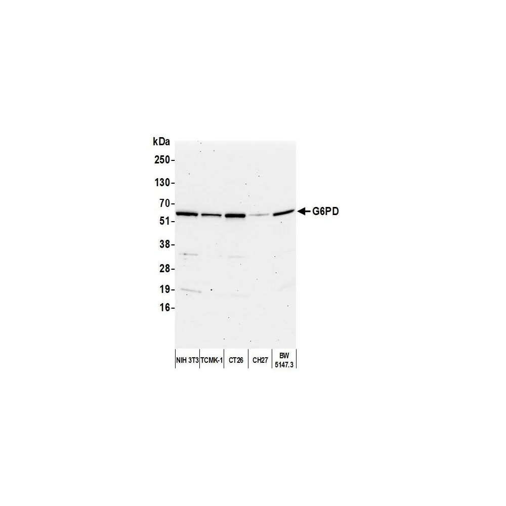 Rabbit anti-G6PD Antibody, Affinity Purified