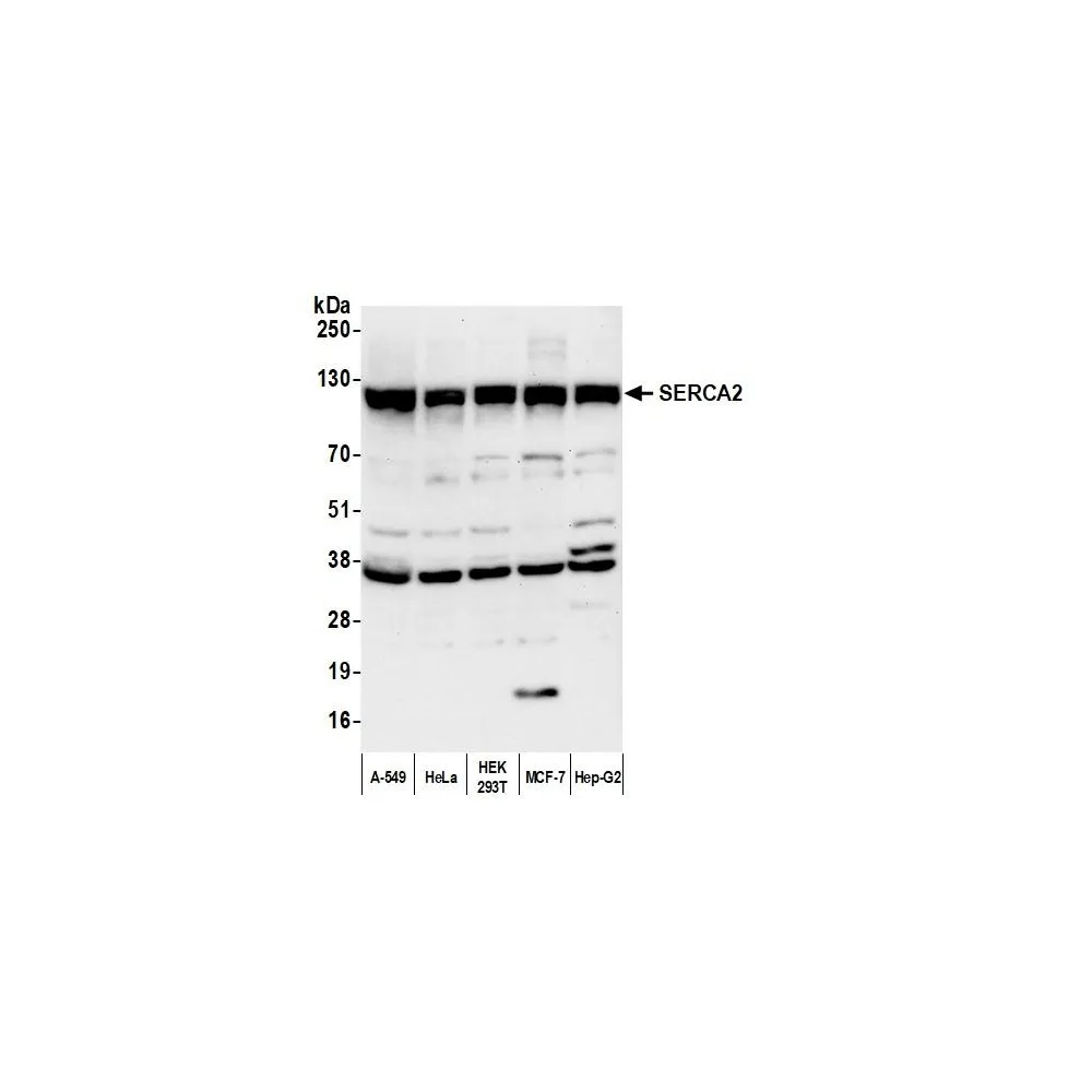 Rabbit anti-SERCA2 Antibody, Affinity Purified