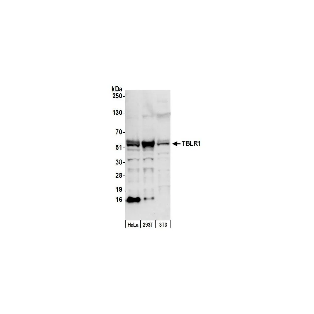 Rabbit anti-TBLR1 Antibody, Affinity Purified