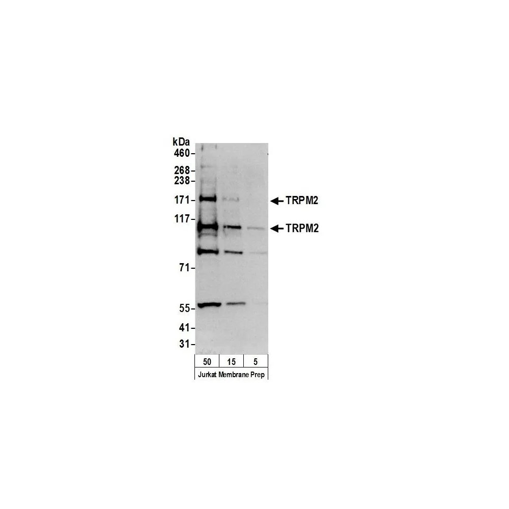 Rabbit anti-TRPM2 Antibody, Affinity Purified