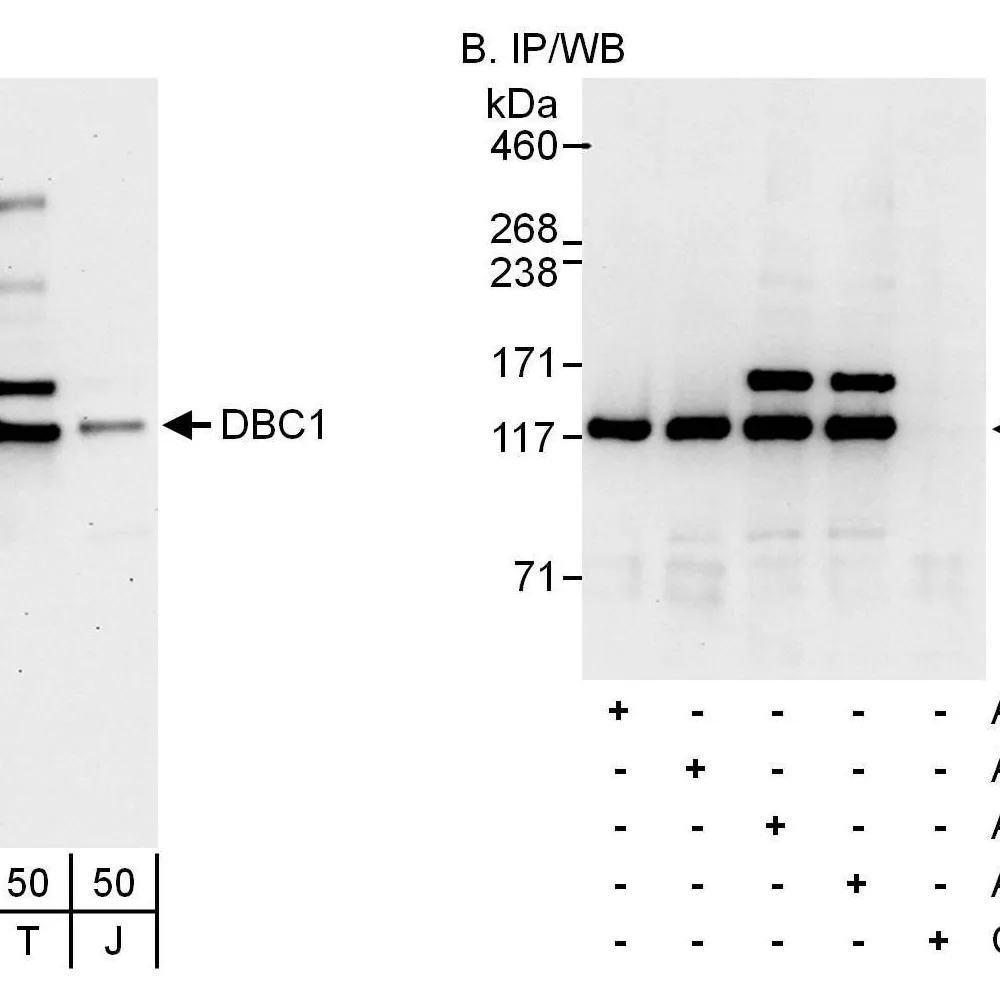 Rabbit anti-DBC1/p30 DBC Antibody, Affinity Purified