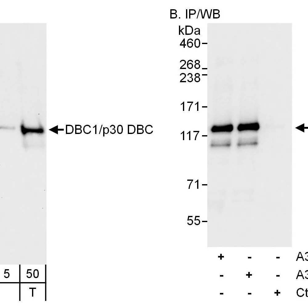 Rabbit anti-DBC1/p30 DBC Antibody, Affinity Purified