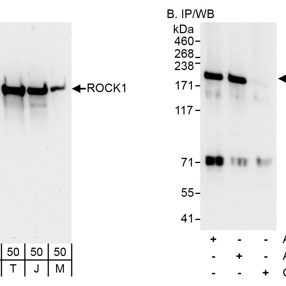 Rabbit anti-ROCK1 Antibody, Affinity Purified