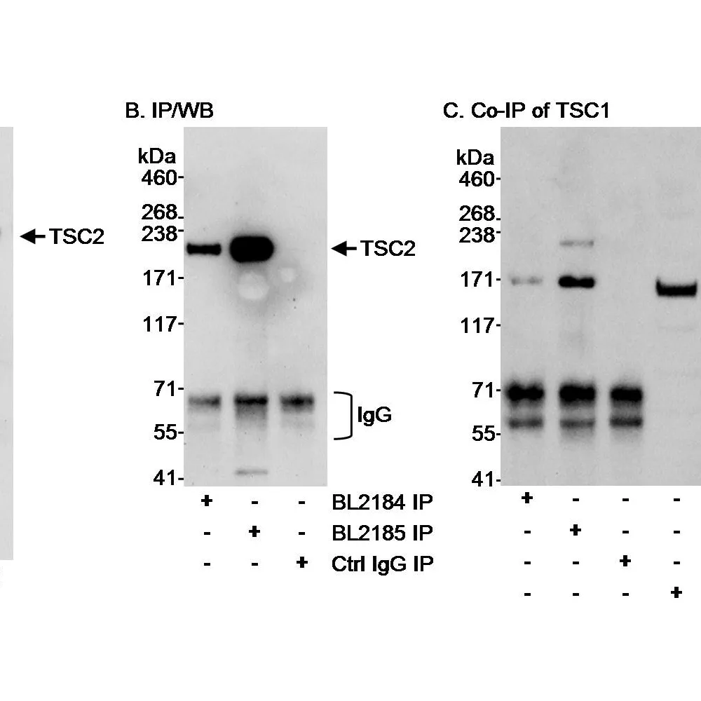 Rabbit anti-TSC2 Antibody, Affinity Purified