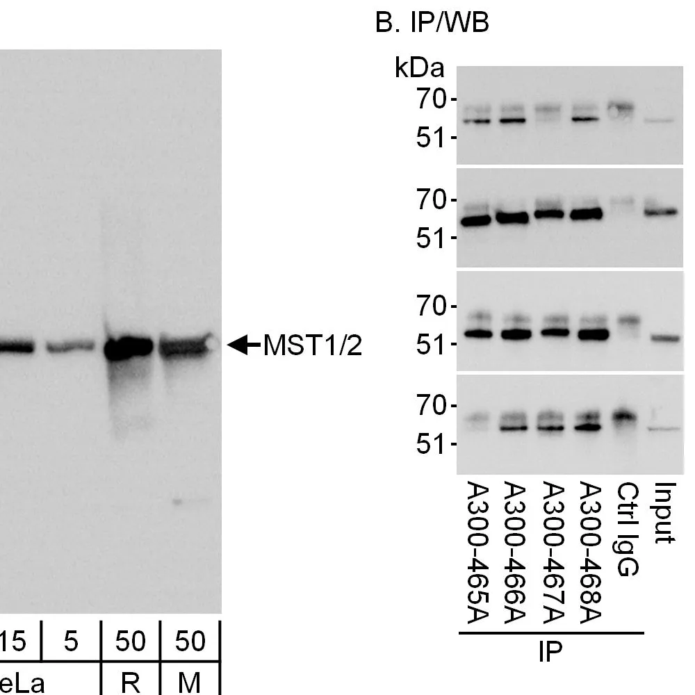 Rabbit anti-MST1-2/STK3-4 Antibody, Affinity Purified