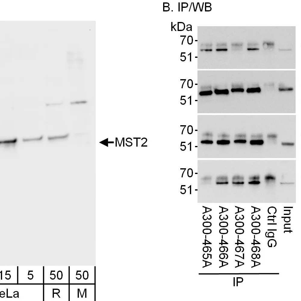 Rabbit anti-MST2/STK3 Antibody, Affinity Purified