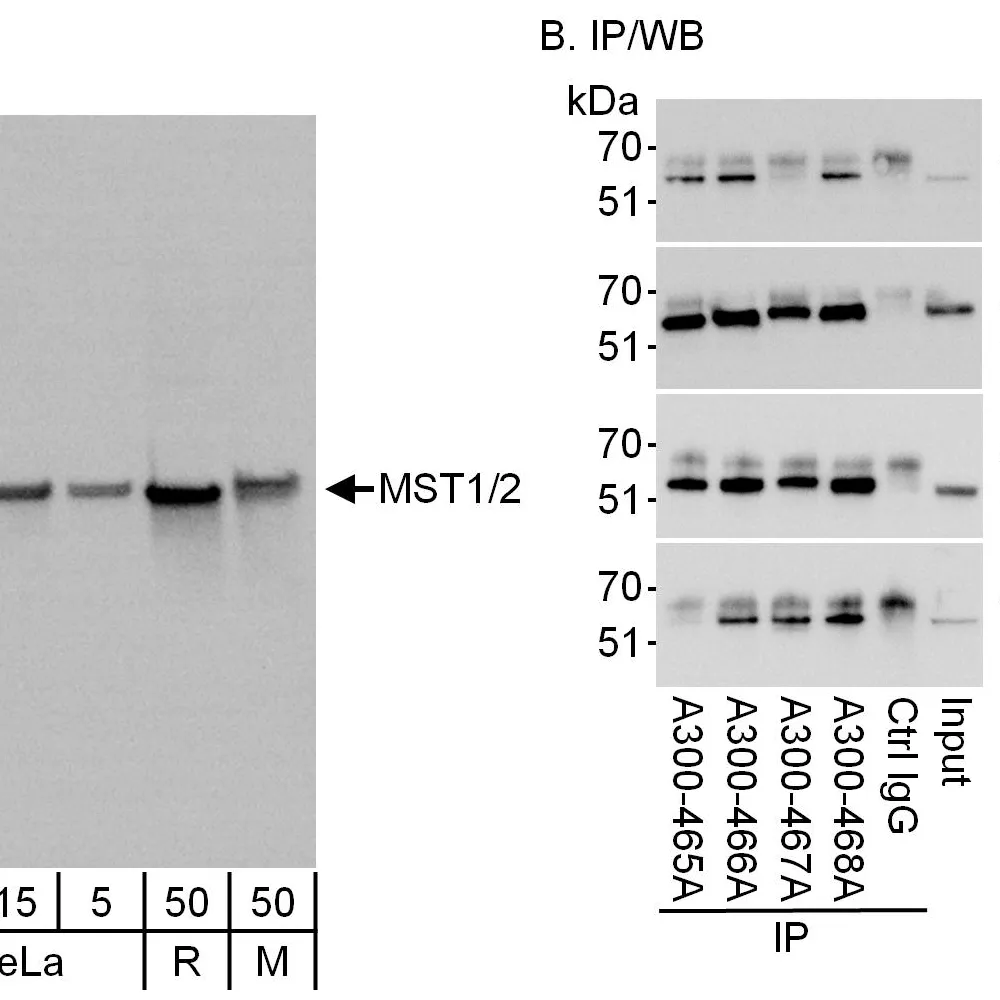 Rabbit anti-MST1-2/STK3-4 Antibody, Affinity Purified