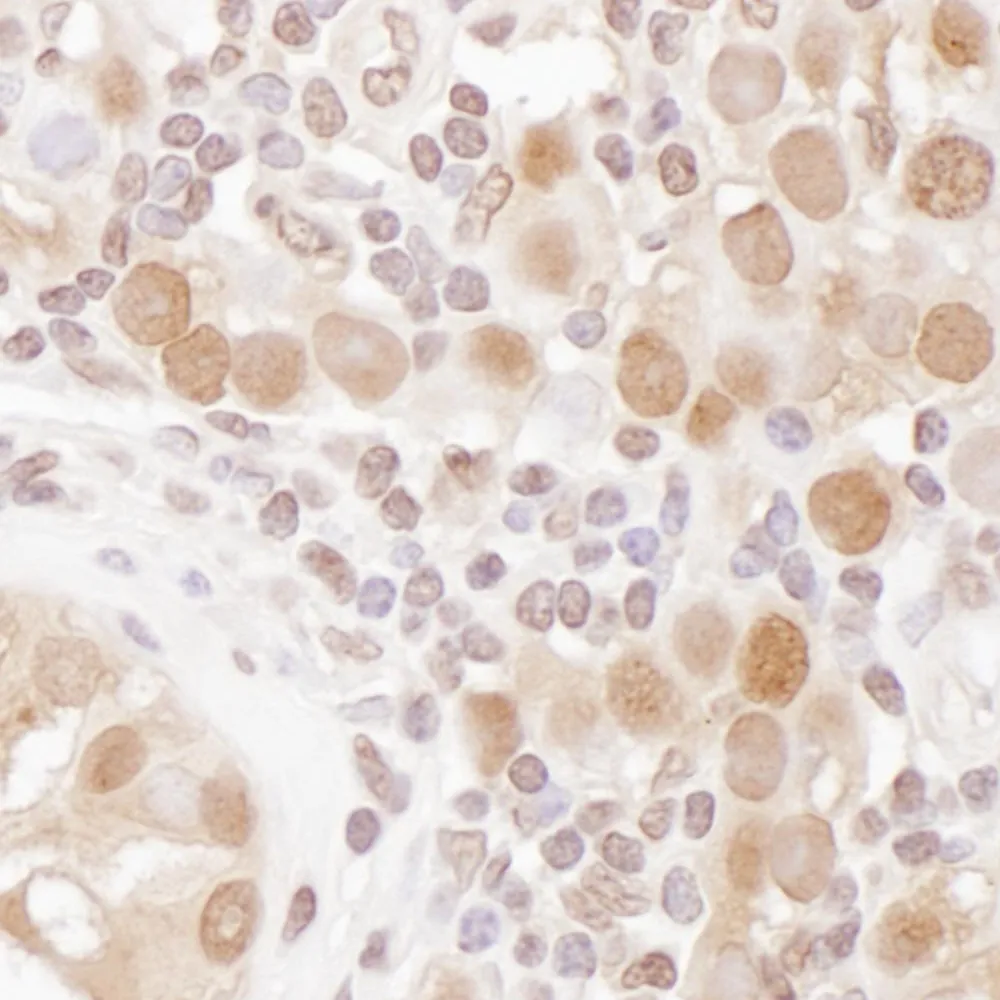 Rabbit anti-CSE1 Antibody, Affinity Purified