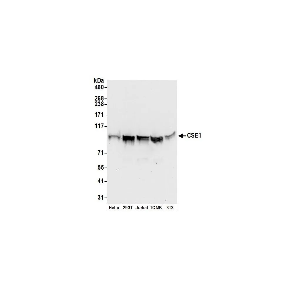 Rabbit anti-CSE1 Antibody, Affinity Purified