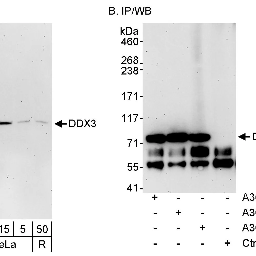 Rabbit anti-DDX3 Antibody, Affinity Purified