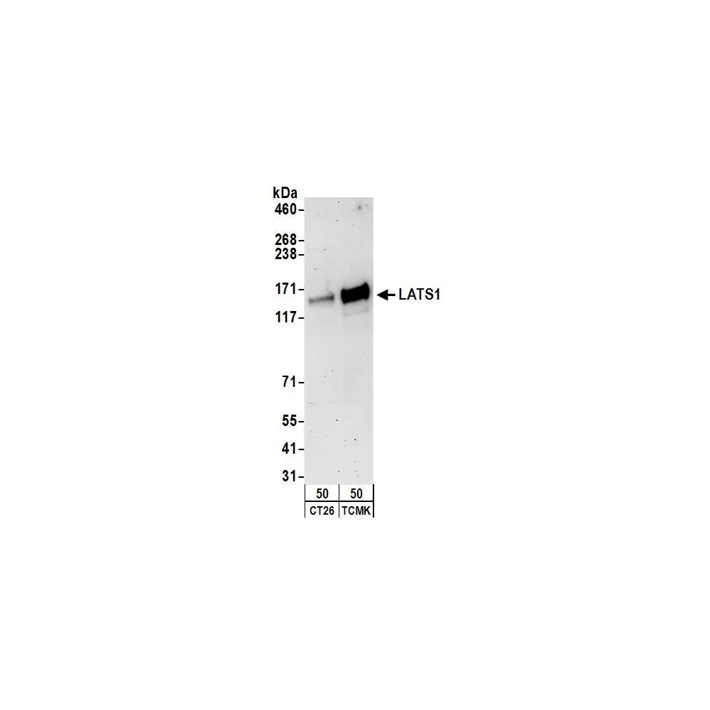 Rabbit anti-LATS1 Antibody, Affinity Purified