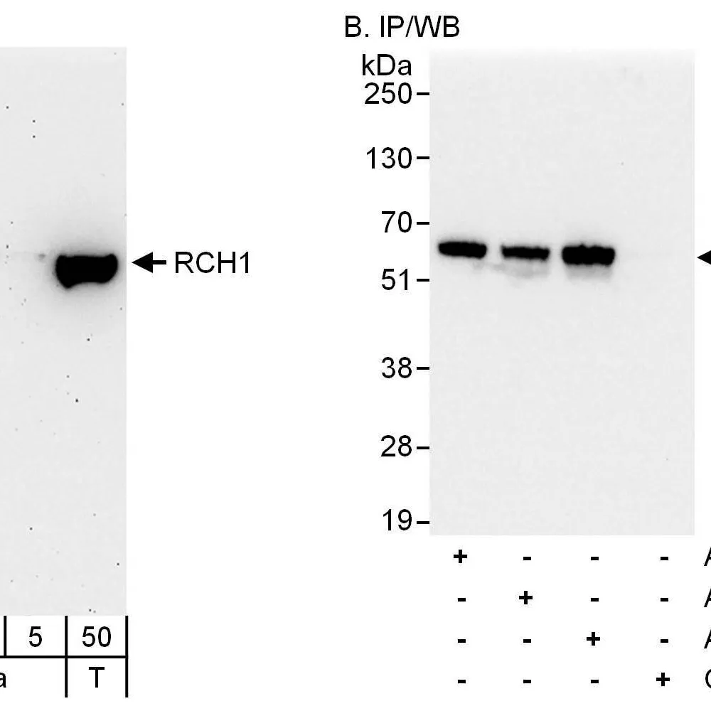 Rabbit anti-RCH1/KPNA2 Antibody, Affinity Purified