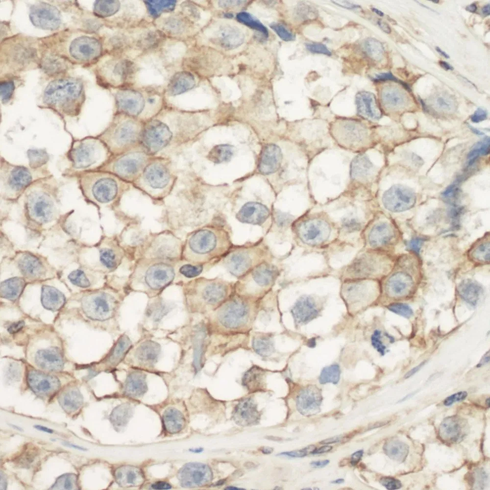 Rabbit anti-Cytoskeletal Actin Antibody, Affinity Purified