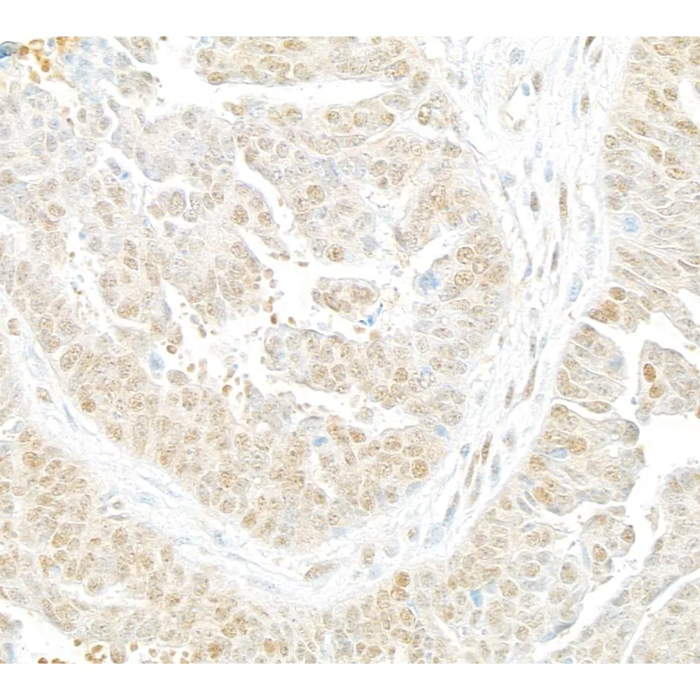 Rabbit anti-Lasu1/Ureb1 Antibody, Affinity Purified