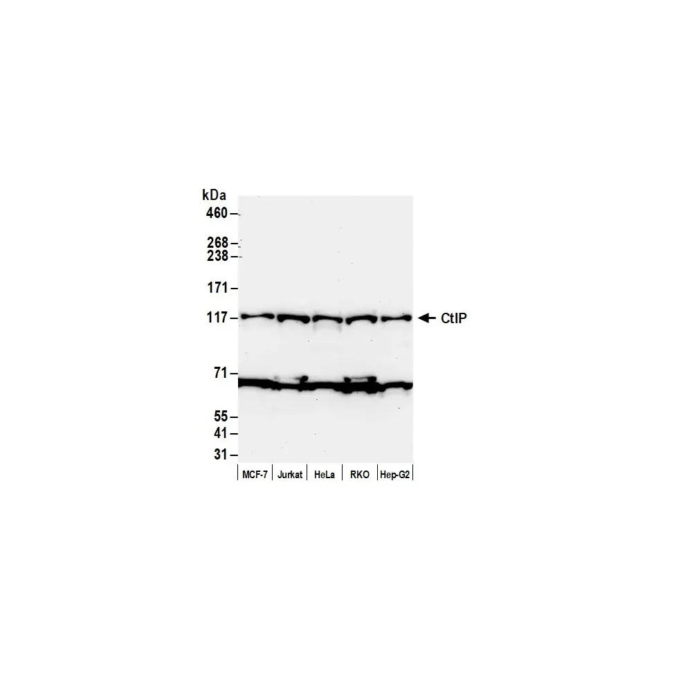 Rabbit anti-CtIP Antibody, Affinity Purified