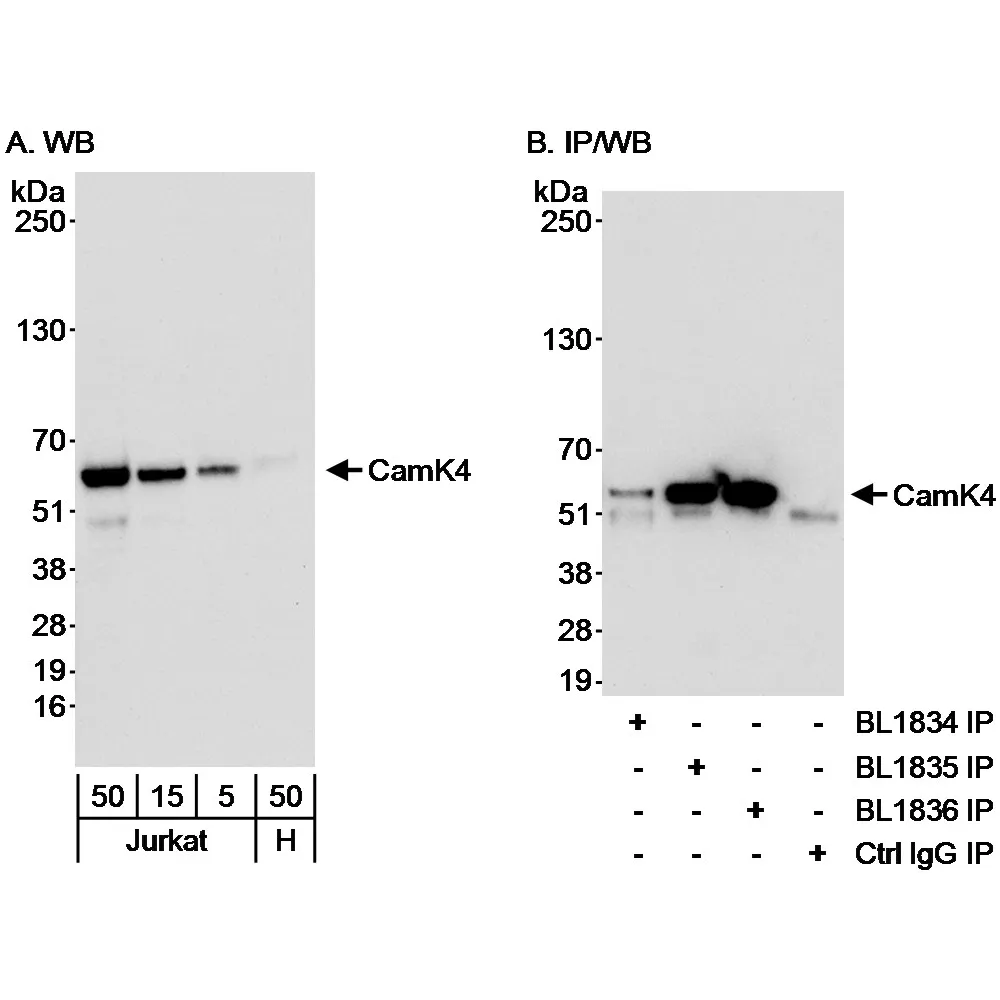 Rabbit anti-CamK4 Antibody, Affinity Purified