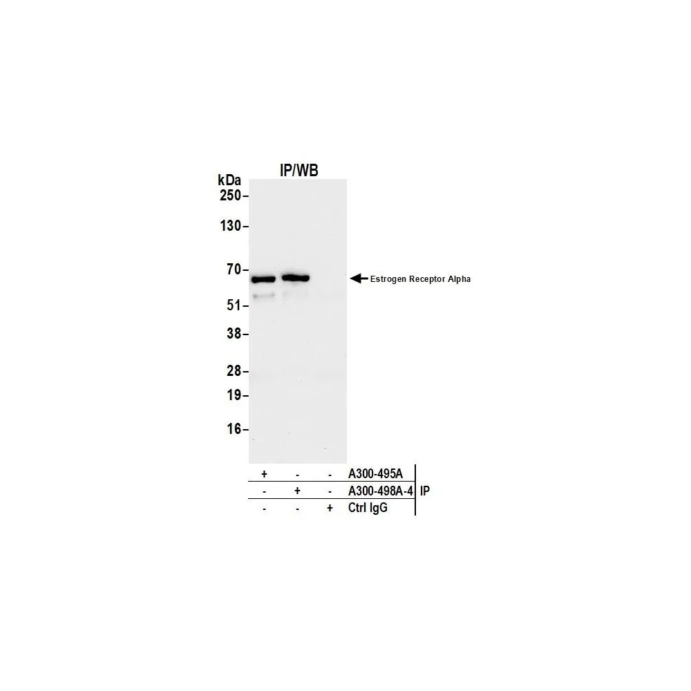 Rabbit anti-Estrogen Receptor Alpha Antibody, Affinity Purified